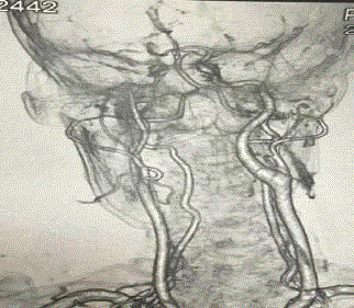 Another alt text